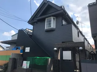ステージ Iの画像